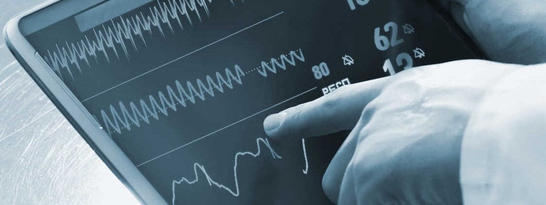 ecg biomedical signal analysis iot ECG digital signal processing, ECG_reference_IPblocks baseline wandering noise reduction 50hz cancellation Savitzky-Golay Filter biomedical signal analysis, ECG signal procssing, ECG DSP