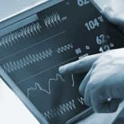ecg biomedical signal analysis iot ECG digital signal processing, ECG_reference_IPblocks baseline wandering noise reduction 50hz cancellation Savitzky-Golay Filter biomedical signal analysis, ECG signal procssing, ECG DSP