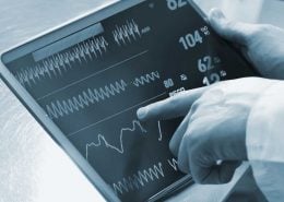 ecg biomedical signal analysis iot ECG digital signal processing, ECG_reference_IPblocks baseline wandering noise reduction 50hz cancellation Savitzky-Golay Filter biomedical signal analysis, ECG signal procssing, ECG DSP