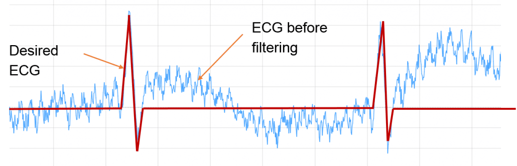 ECG before wanted ECG digital signal processing, ECG_reference_IPblocks baseline wandering noise reduction 50hz cancellation Savitzky-Golay Filter biomedical signal analysis, ECG signal procssing, ECG DSP