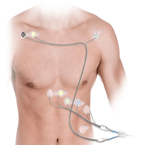 EMB body biomedical iot signal analysisi