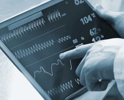 ASN IoT ECG algorithms ECG digital signal processing, ECG_reference_IPblocks baseline wandering noise reduction 50hz cancellation Savitzky-Golay Filter biomedical signal analysis, ECG signal procssing, ECG DSP