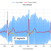 biomedical ex fir td Passing the tainted ECG dataset through our tweaked Savitzky-Golay filter, and adjusting for the group delay