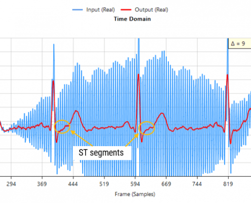 biomedical ex fir td Passing the tainted ECG dataset through our tweaked Savitzky-Golay filter, and adjusting for the group delay