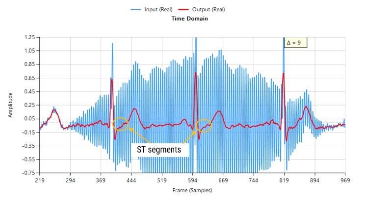 biomedical ex fir td Passing the tainted ECG dataset through our tweaked Savitzky-Golay filter, and adjusting for the group delay