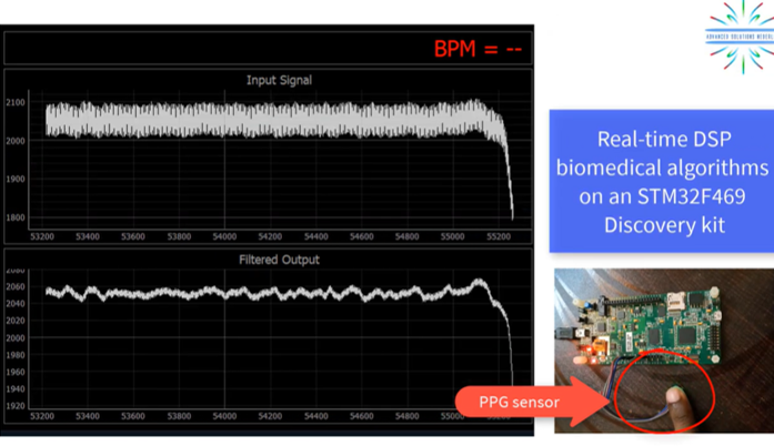 Realtime PPG biomedical algorithms on an STM32F469 Discovery Kit